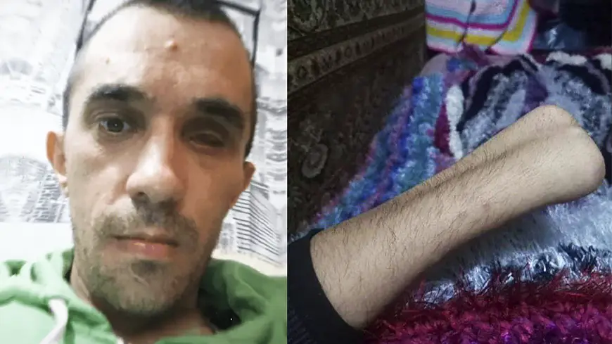 инвалид признанный годным к военной службе